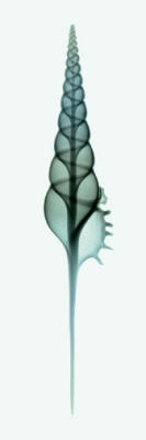 Tibia