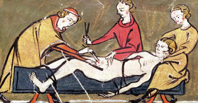 Surgery from an edition of the 'Book of Surgery'